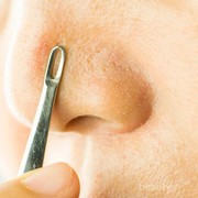 [FORUM] Cara alami hilangkan komedo hitam di hidung yang ampuh