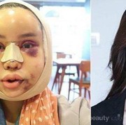 [FORUM] Kalau boleh operasi plastik, bagian tubuh mana yang ingin dirubah?