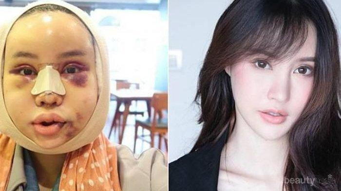 [FORUM] Kalau boleh operasi plastik, bagian tubuh mana yang ingin dirubah?