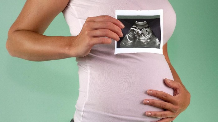The girl is holding a snapshot of an ultrasound twin in the fourth week of pregnancy. First trimester. Confirmation of pregnancy