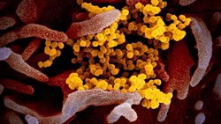 WHO Beberkan Kondisi Khusus Virus Corona Bisa Tertular lewat Udara