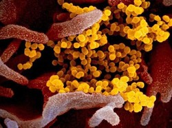 Virus Corona Disebut Bermutasi Jadi 3 Tipe, Wabah di AS Dipicu Tipe Awal