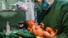 Ketahui Bahaya Pemakaian Masker pada Bayi