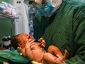 Ketahui Bahaya Pemakaian Masker pada Bayi
