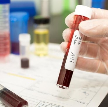 Ini Penyebab Bandung Mendadak Diguncang Kasus HIV/AIDS Terbanyak