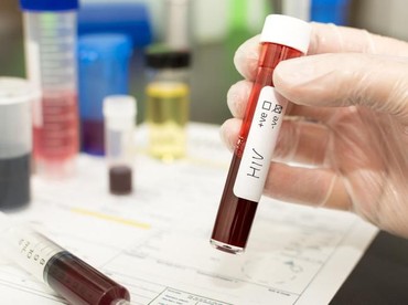 Ini Penyebab Bandung Mendadak Diguncang Kasus HIV/AIDS Terbanyak