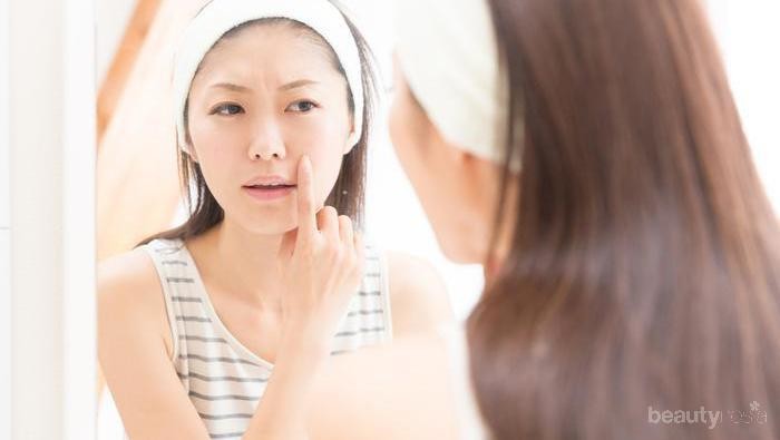 [FORUM] Rekomendasi produk yang bagus untuk kulit berjerawat