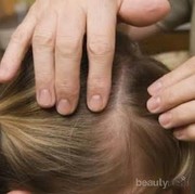 [FORUM] Dear gimana atasin rambut berkutu?