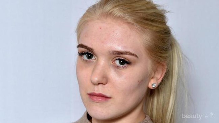 Jangan Disepelekan, Ternyata Kurang Tidur Dapat Membawa 4 Hal Buruk Ini Pada Kecantikan!