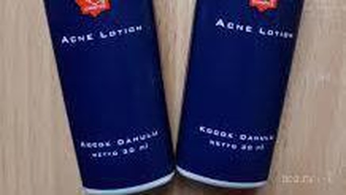 [FORUM] Wah, Viva Acne Lotion Bikin Jerawat Aku Cepat Kempes