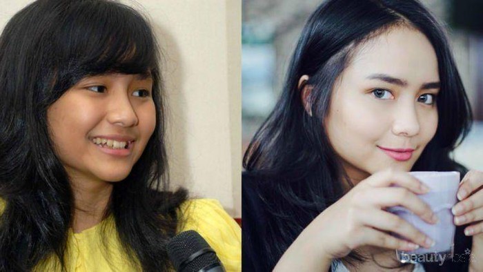 [FORUM] Supaya Wajah Tidak Kusam dan Warnanya Sama dengan Tangan Bagaimana ya? Ada saran...