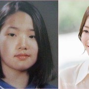 [FORUM] Kenapa sih Orang Korea Cenderung Lebih Banyak yang Oplas?