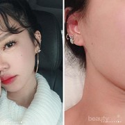 #FORUM Kulit Terlihat Lebih Cerah Tapi Bruntusan Saat Pakai Krim Pemutih, Lanjut Gak?