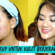 Ingin Mendapatkan Make Up Flawless Pada Kulit Wajah Berjerawat? Yuk Intip Tips ala Alifah Ratu Saelynda!