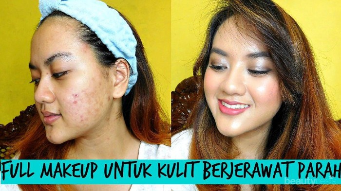 Ingin Mendapatkan Make Up Flawless Pada Kulit Wajah Berjerawat? Yuk Intip Tips ala Alifah Ratu Saelynda!