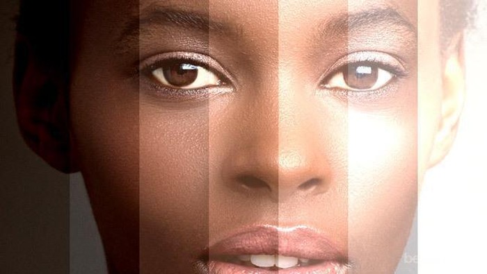 Ingin Memutihkan Kulit? Pahami Berbagai Efek Samping dan Risiko Bleaching Kulit Berikut Ini!