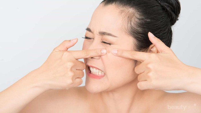 [FORUM] Bahan alami apa yang biasa kamu pakai buat menghilangkan jerawat?