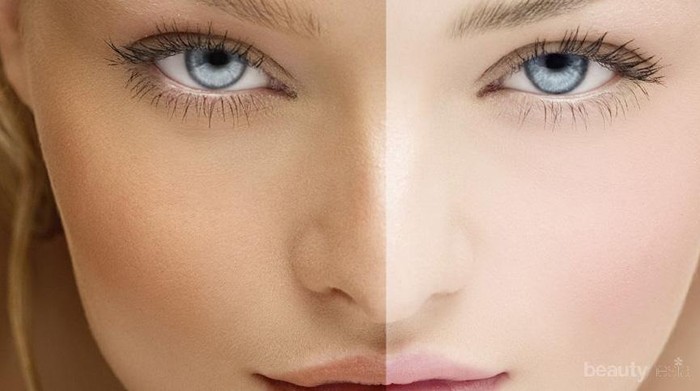 Melakukan Pemutihan Kulit, Ini 5 Cara yang Benar Melakukan Bleaching yang Harus Kamu Tahu