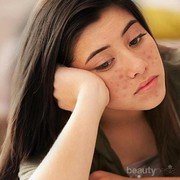 #FORUM Pengalaman kulit wajah rusak saat tidak cocok dengan produk kosmetik