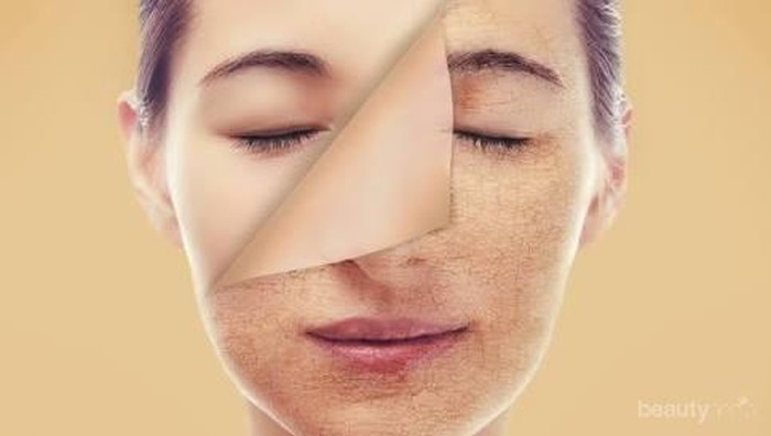 [FORUM] Kulit kombinasi cenderung kering