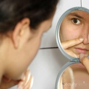 [FORUM] Kalo bagian hidung kering, cara mengatasinya gimana yak?