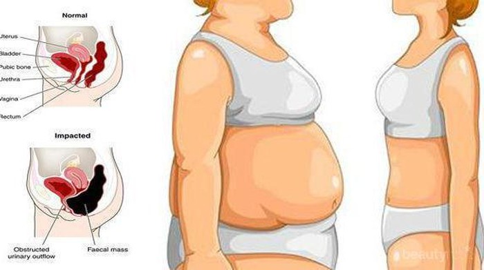 [FORUM] Udah diet tapi Berat badan Gak turun juga!! MINTA TIPSNYA dong! :)