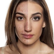 [FORUM] Lebih mending jenis kulit berminyak atau kulit kering?