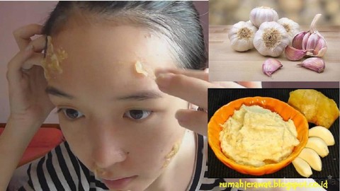 Forum Pakai Bawang Putih Di Muka Beneran Bisa Bikin Kulit Kebakar