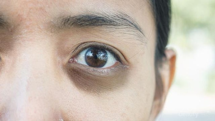 [FORUM] Gimana yaa cara ngilangin mata panda? Saranin produknya yang mantul dong guys