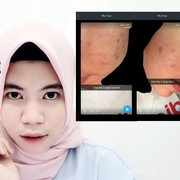 [FORUM] Hijabers, Siapa di sini yang suka pakai toner wardah?