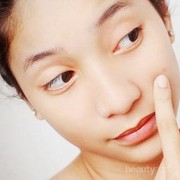 #FORUM Produk apa sih yang efektif membuat jerawat kempes secara cepat?