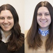 [FORUM] Kalo ga cuci muka seminggu tanpa sabun muka, hasilnya gimana ya?