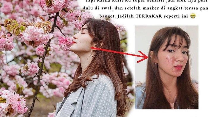 [FORUM] Bukan Bikin Cerah, Masker Lengkoas Malah Bikin Wajah Kebakar!