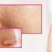 [FORUM] Perawatan Paling Ampuh untuk mengecilkan Pori-pori!