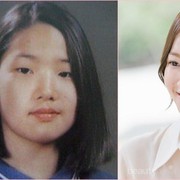 [FORUM] Kalau Boleh Oplas, apa yang mau kamu ubah di tubuh kamu?