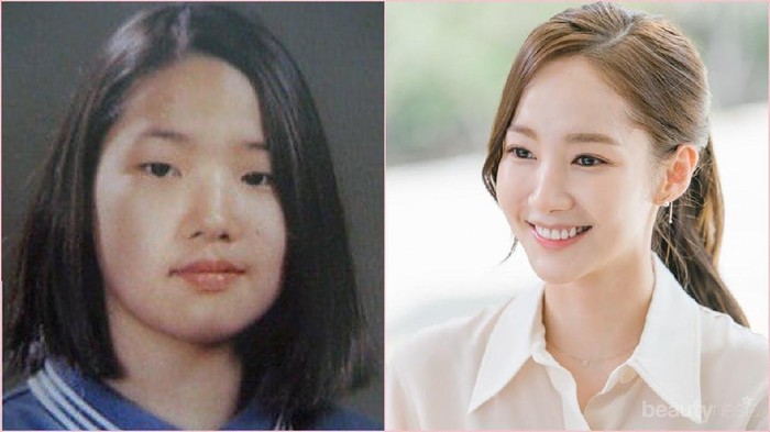 [FORUM] Kalau Boleh Oplas, apa yang mau kamu ubah di tubuh kamu?