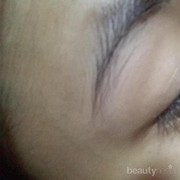 [FORUM] tips ngilangin bintik putih tapi bukan jerawat disekitaran mata hidung