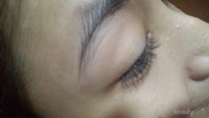 [FORUM] tips ngilangin bintik putih tapi bukan jerawat disekitaran mata hidung