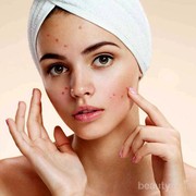 [FORUM] Apa Bedanya Purging dan Breakout?