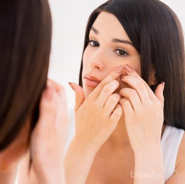 Psst, Ini Tips Mengatasi Jerawat Batu yang Aman dengan Bahan Alami untuk Si Kulit Sensitif