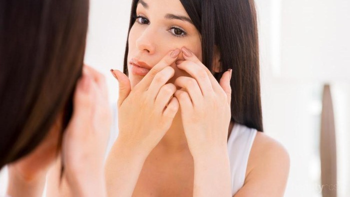 Psst, Ini Tips Mengatasi Jerawat Batu yang Aman dengan Bahan Alami untuk Si Kulit Sensitif Psst, Ini Tips Mengatasi Jerawat Batu yang Aman dengan Bahan Alami untuk Si Kulit Sensitif