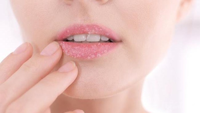 [FORUM] Hobi mengelupas kulit bibir kering sebenernya bahaya nggak ya?