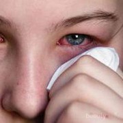 [FORUM] Sharing is Caring, Pengalaman Buruk Pakai Softlens