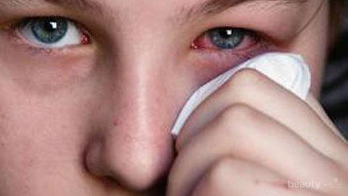 [FORUM] Sharing is Caring, Pengalaman Buruk Pakai Softlens