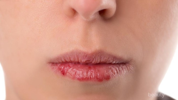 [FORUM] Pengalaman ga sengaja pakai lipstik kadaluwarsa...