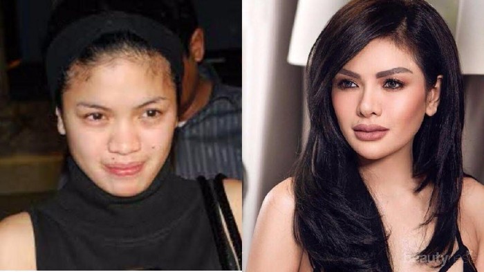 Duh, Artis Indonesia Ini Mengaku Operasi Plastik Duh, Artis Indonesia Ini Mengaku Operasi Plastik