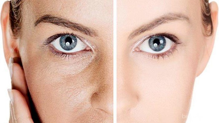 Punya Masalah Pori-pori Besar? Simak 4 Rekomendasi Produk Lokal Ampuh Ini!