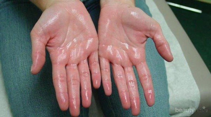 [FORUM] Telapak tangan gampang basah, sebenarnya berbahayakah?