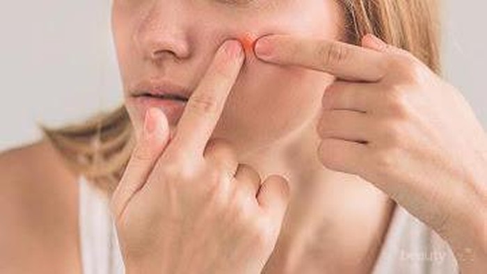 #FORUM Share dong obat jerawat andalan kalian apa?