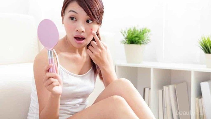 [FORUM] Siapa di sini yang kalau lagi stress selalu langsung jerawatan?